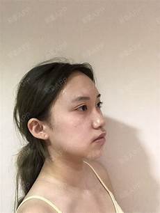 被害妄想症有什么表现症状